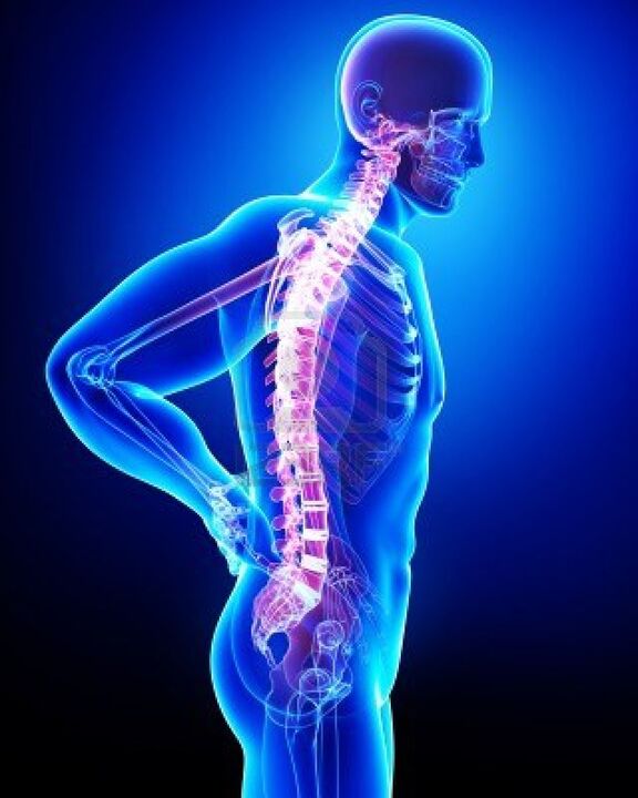 กระดูกสันหลังของมนุษย์ได้รับผลกระทบจาก osteochondrosis